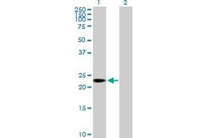 Western Blot analysis of C1orf83 expression in transfected 293T cell line by C1orf83 MaxPab polyclonal antibody. (TCEANC2 Antikörper  (AA 1-208))