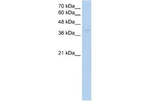 RNF165 antibody used at 1 ug/ml to detect target protein. (RNF165 Antikörper  (Middle Region))