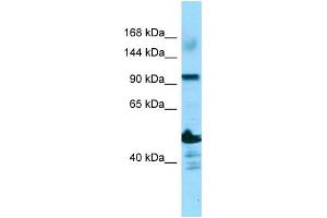 WB Suggested Anti-ADAMTS14 Antibody Titration: 1. (ADAMTS14 Antikörper  (N-Term))