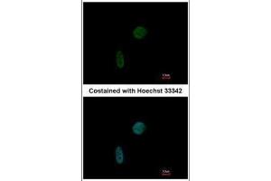 Immunofluorescence (IF) image for anti-CDKN1A Interacting Zinc Finger Protein 1 (CIZ1) antibody (ABIN2855299)
