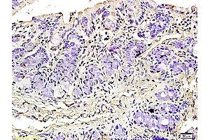 Formalin-fixed and paraffin embedded rat colitis tissue labeled with Rabbit Anti-Podoplanin/gp36 Polyclonal Antibody (ABIN736896), Unconjugated 1:200 followed by conjugation to the secondary antibody and DAB staining (Podoplanin Antikörper  (AA 91-166))