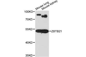 Western blot analysis of extracts of various cell lines, using ZBTB21 antibody (ABIN6291079) at 1:3000 dilution.