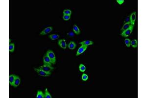 Immunofluorescent analysis of HepG2 cells using ABIN7150038 at dilution of 1:100 and Alexa Fluor 488-congugated AffiniPure Goat Anti-Rabbit IgG(H+L) (ADAM12 Antikörper  (AA 730-909))