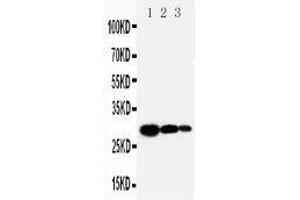 Anti-TIMP1 antibody, Western blotting Lane 1: Recombinant Human TIMP-1 Protein 10ng Lane 2: Recombinant Human TIMP-1 Protein 5ng Lane 3: Recombinant Human TIMP-1 Protein 2.