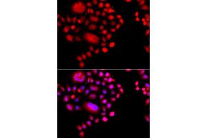 Immunofluorescence analysis of A549 cell using POLR1D antibody.