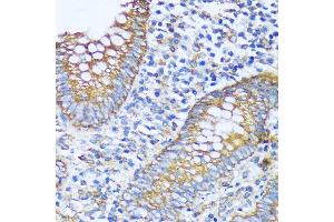 Immunohistochemistry of paraffin-embedded human appendix using  antibody (ABIN7265428) at dilution of 1:100 (40x lens). (ACOT2 Antikörper  (AA 222-483))