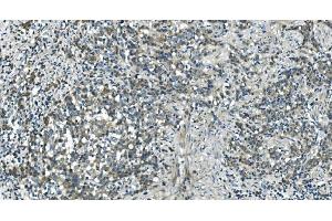 IHC analysis of CDC123 using anti-CDC123 antibody (ABIN7599284).