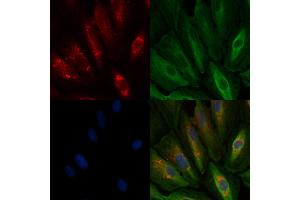 ABIN6259993 and ABIN6278082 staining  cells by IF/ICC. (Apolipoprotein D Antikörper  (Internal Region))