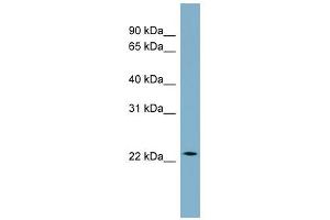 WB Suggested Anti-CCDC25 Antibody Titration: 0. (CCDC25 Antikörper  (Middle Region))