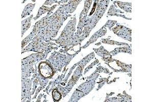 IHC analysis of H Cadherin/CDH13 using anti-H Cadherin/CDH13 antibody (ABIN7600095). (Cadherin 13 Antikörper  (AA 149-692))