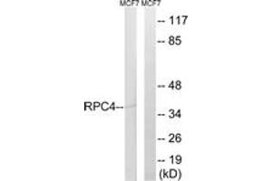 Western blot analysis of extracts from MCF-7 cells, using RPC4 Antibody. (POLR3D Antikörper  (AA 281-330))