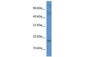 Western Blot showing CGB antibody used at a concentration of 1.