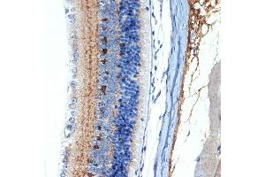 Immunohistochemistry (IHC) image for anti-Cellular Retinoic Acid Binding Protein 1 (CRABP1) antibody (ABIN7266269)
