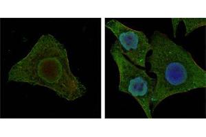 Confocal immunofluorescence analysis of MCF-7 (left) and HepG2 (right) cells using BRAF mouse mAb (green). (BRAF Antikörper)