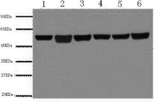 Western Blotting (WB) image for anti-Tubulin, beta (TUBB) antibody (ABIN5957718) (TUBB Antikörper)