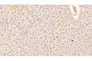 Detection of C3a in Mouse Liver Tissue using Polyclonal Antibody to Complement Component 3a (C3a) (C3a Antikörper  (AA 671-748))