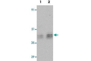 Western blot analysis of human testis tissue with ESX1 polyclonal antibody  at (Lane 1) 1 and (Lane 2) 2 ug/mL dilution. (ESX Homeobox 1 Antikörper)