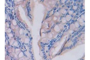 Used in DAB staining on fromalin fixed paraffin- embedded testis tissue (Fatty Acid Synthase Antikörper  (AA 2257-2504))