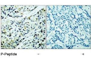 Image no. 1 for anti-Histone Deacetylase 5 (HDAC5) (pSer498) antibody (ABIN196932) (HDAC5 Antikörper  (pSer498))