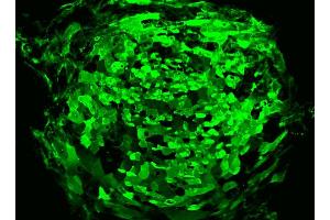 Immunofluorescent staining of human ES cell line. (TRA1-81 Antikörper)