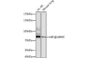 Western blot analysis of extracts of various cell lines, using HIF1β/ARNT antibody (ABIN3021190, ABIN3021191, ABIN3021192 and ABIN6214058) at 1:1000 dilution. (ARNT Antikörper  (AA 400-500))