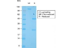 SDS-PAGE Analysis of Purified TIMP1 Rabbit Recombinant Monoclonal Antibody (TIMP1/1944R). (Rekombinanter TIMP1 Antikörper)