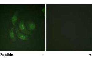 Immunofluorescence analysis of HepG2 cells, using CAMK4 polyclonal antibody . (CAMK4 Antikörper)