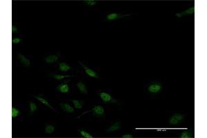 Immunofluorescence of purified MaxPab antibody to MSX2 on HeLa cell. (Msx2/Hox8 Antikörper  (AA 1-267))
