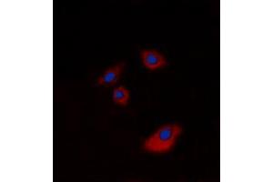 Immunofluorescent analysis of Cytokeratin 20 staining in A549 cells. (KRT20 Antikörper  (C-Term))