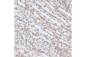 Immunohistochemistry of paraffin-embedded mouse kidney using ZNF581 antibody (ABIN6128960, ABIN6150520, ABIN6150521 and ABIN6217055) at dilution of 1:100 (40x lens).