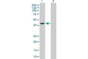 Western Blot analysis of CD58 expression in transfected 293T cell line by CD58 MaxPab polyclonal antibody. (CD58 Antikörper  (AA 1-250))