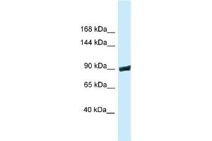 WB Suggested Anti-Dnm3 Antibody Titration: 1.