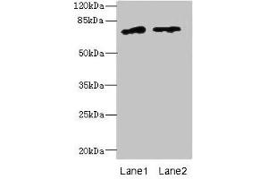 Western blot All lanes: ENOX1 antibody at 5 μg/mL Lane 1: Jurkat whole cell lysate Lane 2: Raji whole cell lysate Secondary Goat polyclonal to rabbit IgG at 1/10000 dilution Predicted band size: 74, 28 kDa Observed band size: 74 kDa (ENOX1 Antikörper  (AA 101-340))