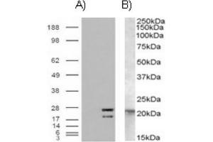 Image no. 1 for anti-GTPase NRas (NRAS) (Internal Region) antibody (ABIN375000) (GTPase NRas Antikörper  (Internal Region))