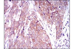 Image no. 1 for anti-MAP/microtubule Affinity-Regulating Kinase 3 (MARK3) antibody (ABIN1491518) (MARK3 Antikörper)