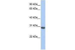 WB Suggested Anti-MLF1 Antibody Titration: 0.
