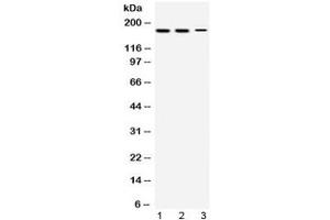 Western blot testing of 1) rat testis, 2) mouse testis and 3) human HepG2 lysate with KDM5B antibody at 0. (KDM5B Antikörper  (AA 641-685))