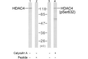 Image no. 1 for anti-Histone Deacetylase 4 (HDAC4) (pSer632) antibody (ABIN196931) (HDAC4 Antikörper  (pSer632))