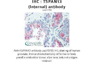 Image no. 1 for anti-Tetraspanin 13 (TSPAN13) (Internal Region) antibody (ABIN1740425) (TSPAN13 Antikörper  (Internal Region))