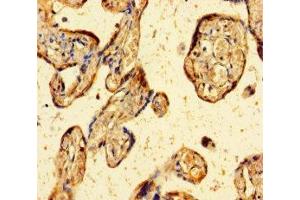 Immunohistochemistry of paraffin-embedded human placenta tissue using ABIN7176020 at dilution of 1:100 (ZBED1 Antikörper  (AA 1-210))