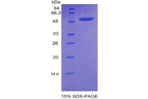 SDS-PAGE (SDS) image for Cadherin 13 (CDH13) (AA 478-690) protein (His tag,GST tag) (ABIN1878452)