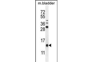 KT Antibody (C-term) (ABIN655129 and ABIN2844756) western blot analysis in mouse bladder tissue lysates (35 μg/lane). (KRTCAP2 Antikörper  (C-Term))