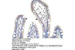 Human Intestine (METTL3 Antikörper  (N-Term))