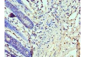 Immunohistochemistry of paraffin-embedded human colon tissue using ABIN7173934 at dilution of 1:100 (TP53BP1 Antikörper  (AA 1758-1972))