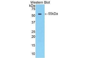 Western Blotting (WB) image for anti-Cathepsin A (CTSA) (AA 151-394) antibody (ABIN1858534)