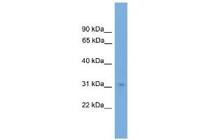 NRBF2 antibody used at 1 ug/ml to detect target protein. (NRBF2 Antikörper  (N-Term))