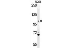Western Blotting (WB) image for anti-ArfGAP with Coiled-Coil, Ankyrin Repeat and PH Domains 3 (Acap3) antibody (ABIN3002257) (Acap3 Antikörper)