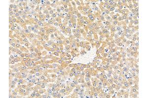 ABIN7094876 and ABIN7098928 at 1/100 staining Rat liver tissue by IHC-P. (MUT Antikörper  (N-Term))