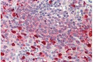 Immunohistochemistry (IHC) image for anti-Cyclin-Dependent Kinase Inhibitor 2D (p19, Inhibits CDK4) (CDKN2D) (AA 15-43) antibody (ABIN1977661)