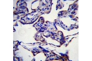 Immunohistochemistry (IHC) image for anti-Fatty Acid Synthase (FASN) (AA 942-973) antibody (ABIN3030916)